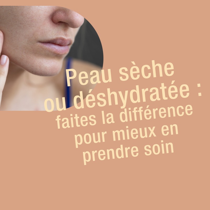 peau sèche ou déshydratée